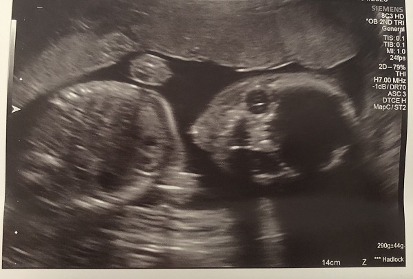 baby C