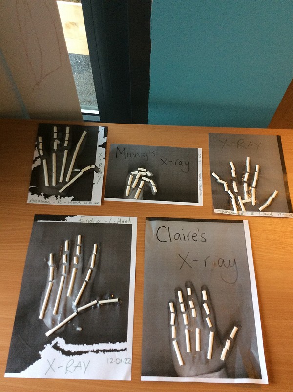 skeleton